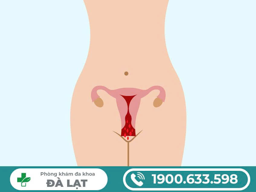 Hình ảnh minh họa